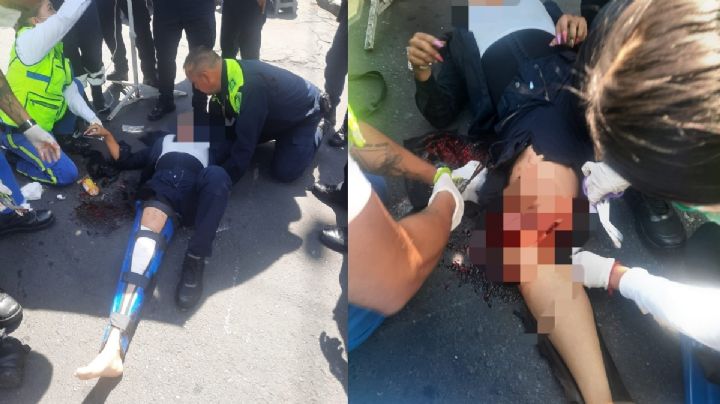 Conductor atropella y le rompe la pierna a mujer policía en el Centro CDMX